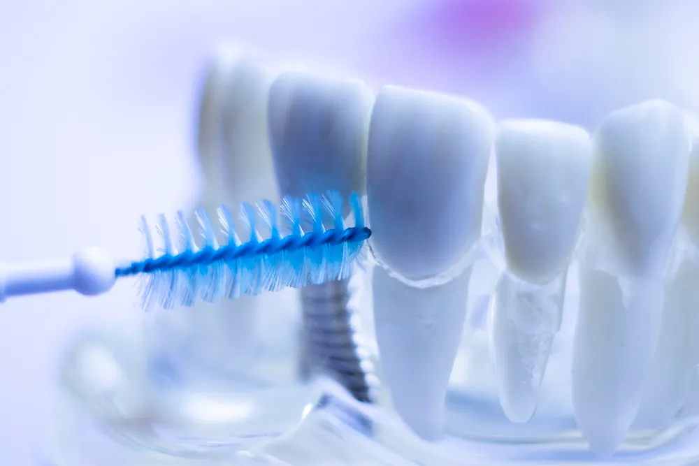 Keuntungan saka sikat interdental kanggo untu