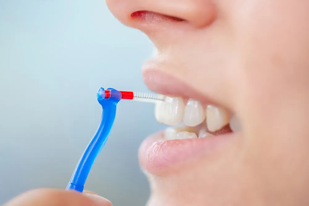 Cara sing bener kanggo nggunakake sikat interdental